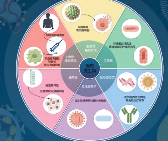 瘤內(nèi)微生物群對(duì)?腫瘤免疫治療效果與發(fā)展的影響