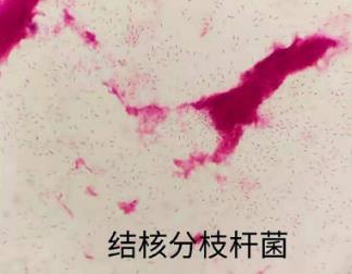 分枝桿菌在貓、狗、鳥中的流行和傳播途徑