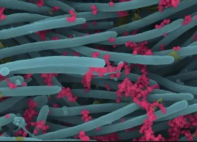 基于低生物量微生物富集方法觀察ICU患者下呼吸道微生物組的功能和進化動態(tài)