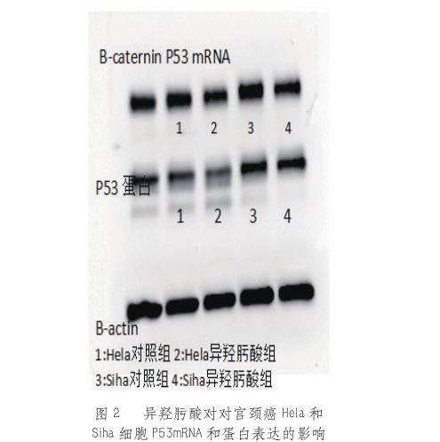新型靶向抗癌藥HDAC抑制劑可誘導(dǎo)腫瘤細胞分化、選擇性凋亡——結(jié)果與討論