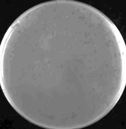 尿路致病性大腸桿菌噬菌體核酸類型、生物學特性分析——摘要、材料和方法