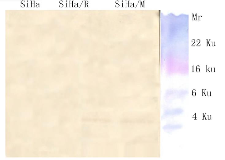 Annexin V聯(lián)合PI法、TUNEL法測定：防御素可誘導(dǎo)轉(zhuǎn)染細胞SiHa凋亡（一）