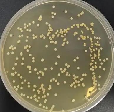 什么是球菌感染？疑似球菌1000多是怎么回事？球菌會(huì)傳染人嗎