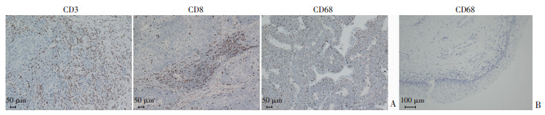 CLDN10信號(hào)通路對(duì)膀胱癌細(xì)胞生長(zhǎng)和增殖的作用（一）